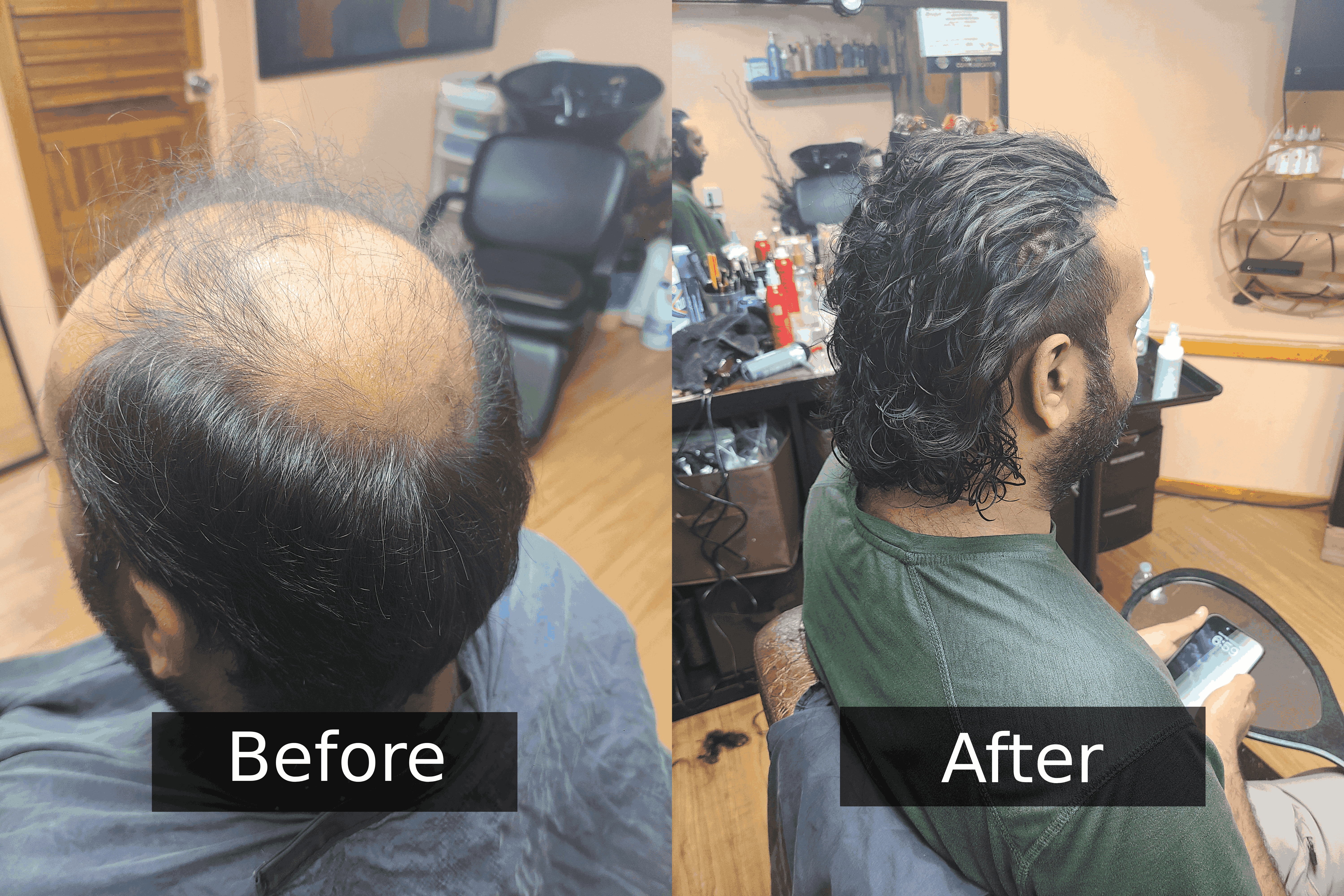 Hair replacement (2)